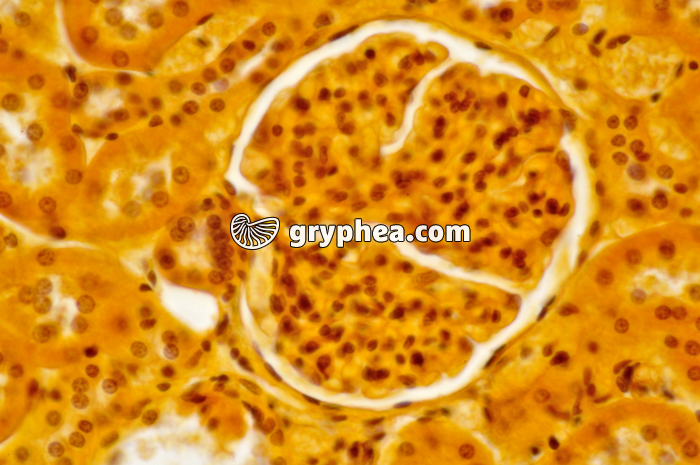 Glomérule Rein x160 - gryphea.com